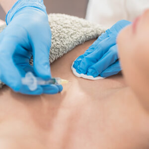 Rejuvenecimiento escote, manos, cuello